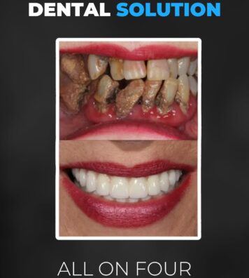 Copy of Black Pink Black Friday Sale Instagram Reel (1920 x 1920 px) (Your Story)